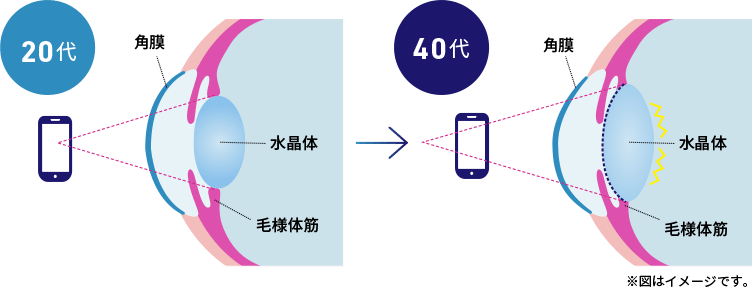 20代と40代の眼の比較図。※図はイメージです。