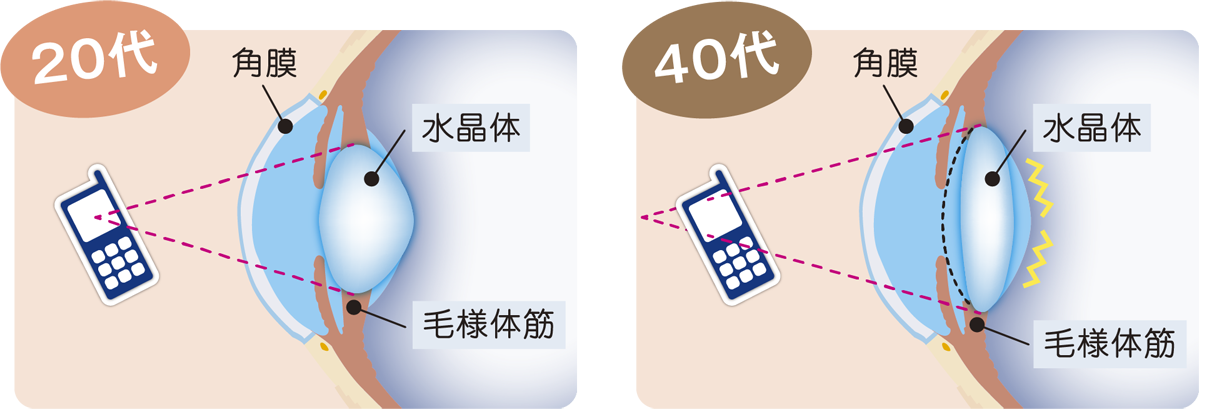 20代と40代の差