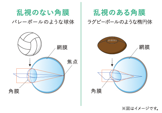 知っているようで知らない 乱視 の話 コンタクトレンズ コンタクトレンズのシード Seed